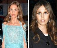 allegra versace antes y despues